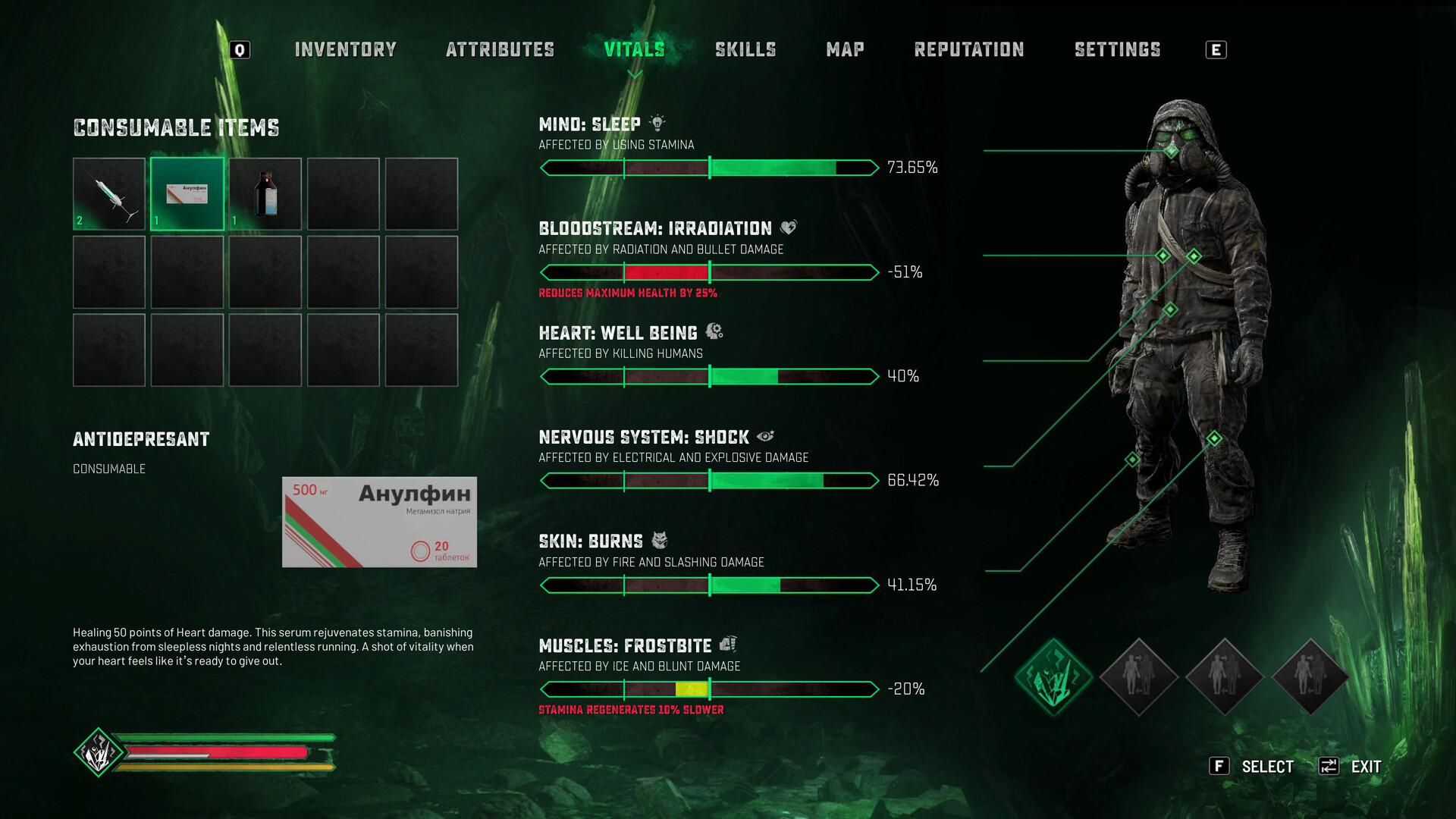 《切尔诺贝利人2：禁区/Chernobylite 2: Exclusion Zone》PC中文版下载-含v77150插图1